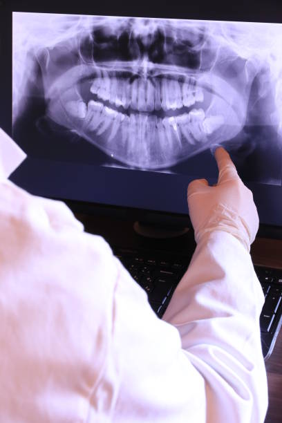 Best Broken or Chipped Tooth Repair in Fort Thomas, KY